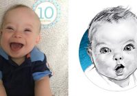 Нове обличчя фірми дитячого харчування — хлопчик із синдромом Дауна