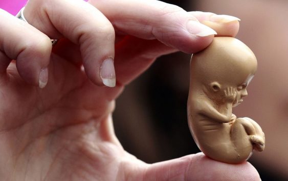 Дітям дозволять робити аборт без дозволу батьків?