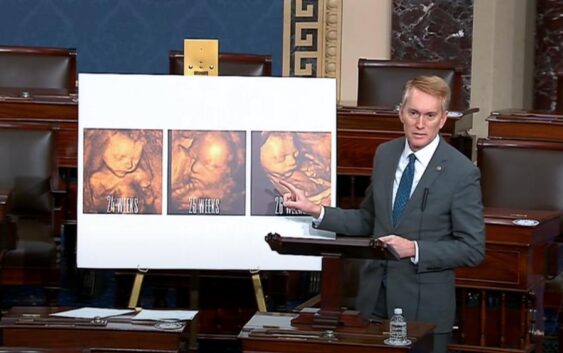 “Це дитина?” – Сенатор США показав фото ненародженої дитини та виступив з шокуючою промовою