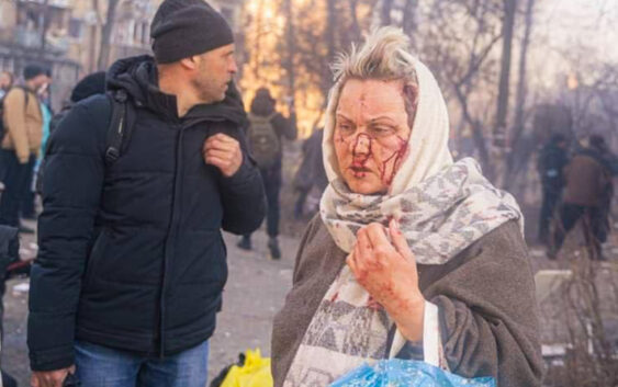 Глава УГКЦ до людей світу: «Війна в Україні – це не комп’ютерна гра, це реальний біль людей»